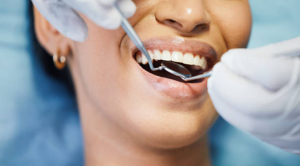 Best Emergency Wisdom Tooth Extraction in North Terre Haute, IN